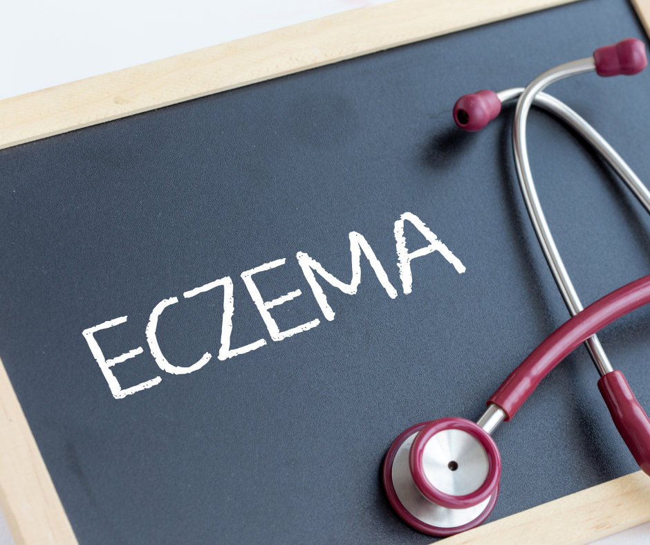 Should a child who has eczema see a dermatologist?
