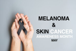 Melanoma , Skin Cancer Awareness