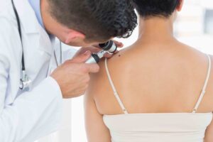 Male,Dermatologist,Examining,Mole,On,Back,Of,Woman,In,Clinic