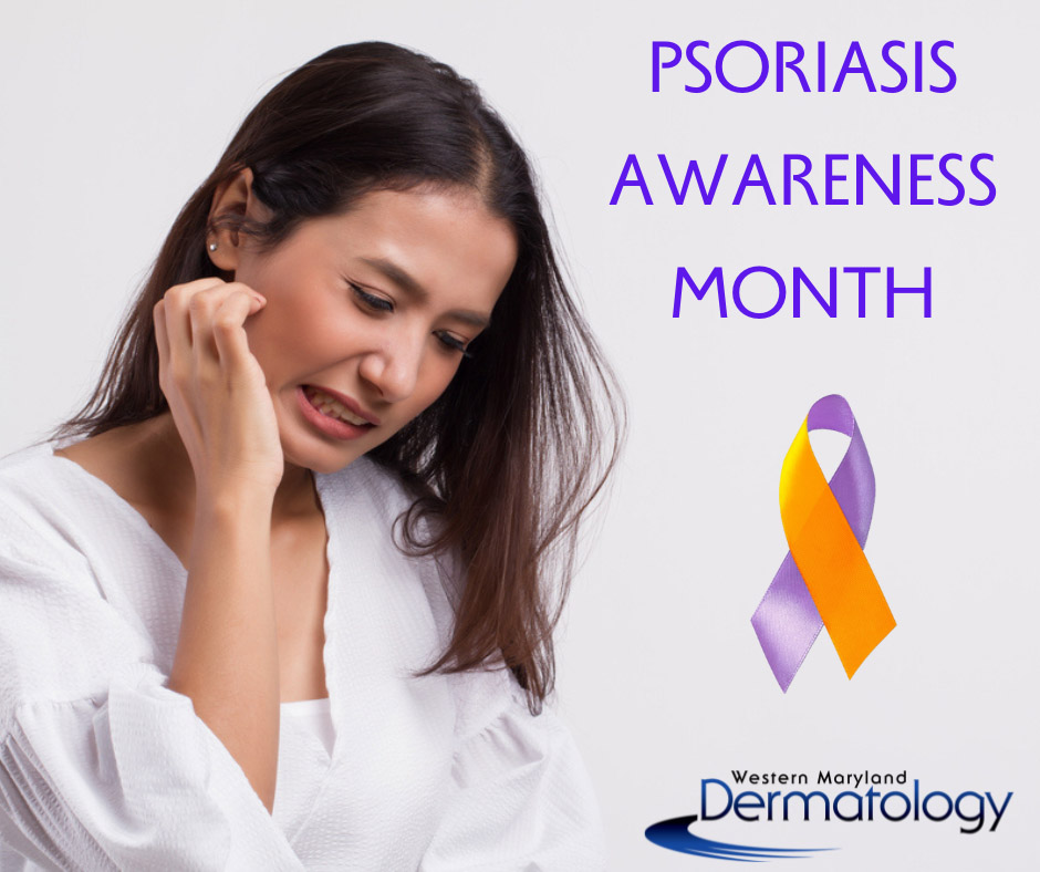 Understanding Psoriasis:A Comprehensive Guide for Psoriasis Awareness Month