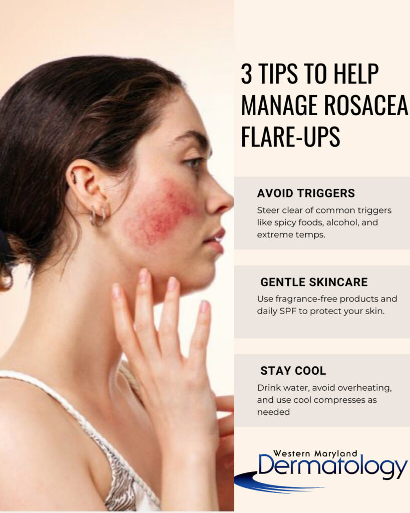 Rosascea Awareness Month
