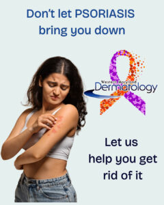 Don’t let PSORIASIS bring you down - 1