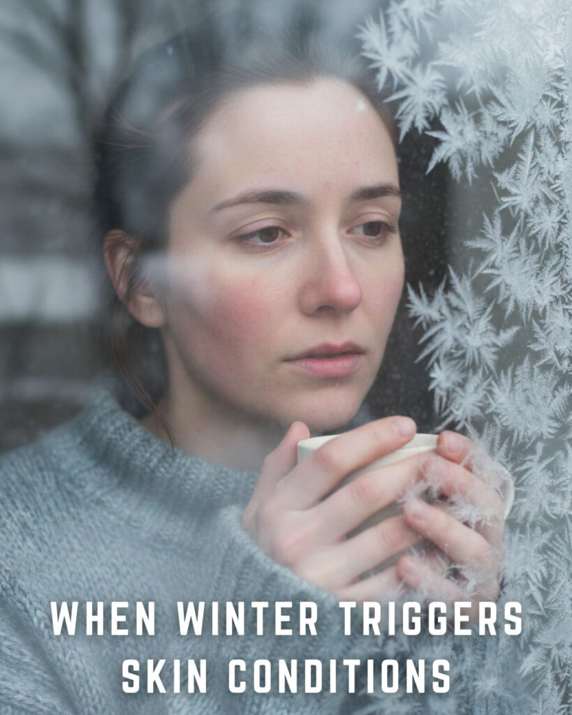 Managing Eczema, Rosacea, and Psoriasis During the Winter Months
